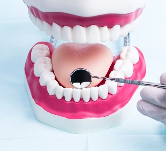 imagen de Odontologia Conservadora en bermeo tratamientos clinica dental